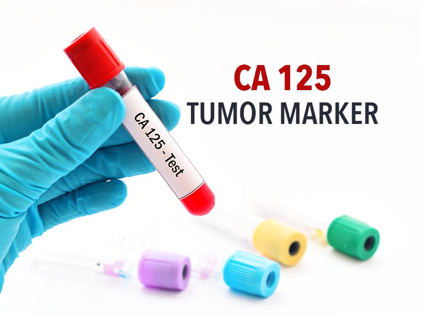 CA125【糖类抗原125单克隆抗体】说明书(图2)